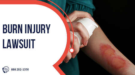 Burn Injury Lawsuit