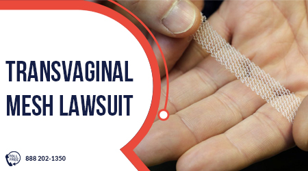 Transvaginal Mesh Lawsuit